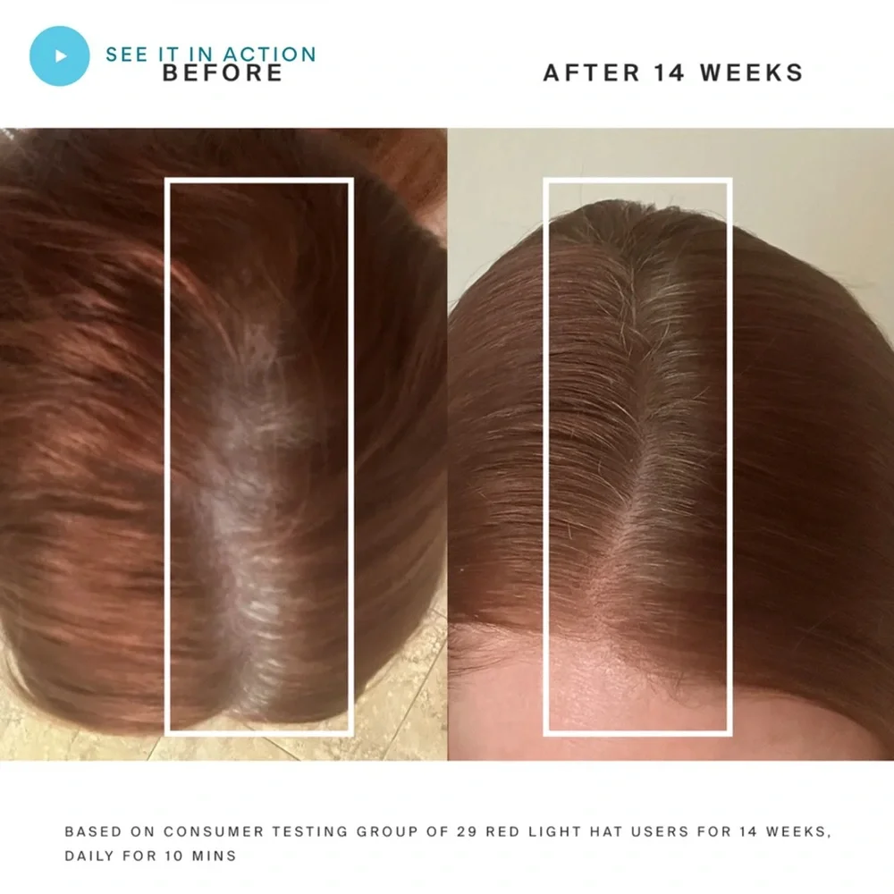 Higherdose Red Light Hat - Black (Like New w/ Box) - Picture 4 of 9